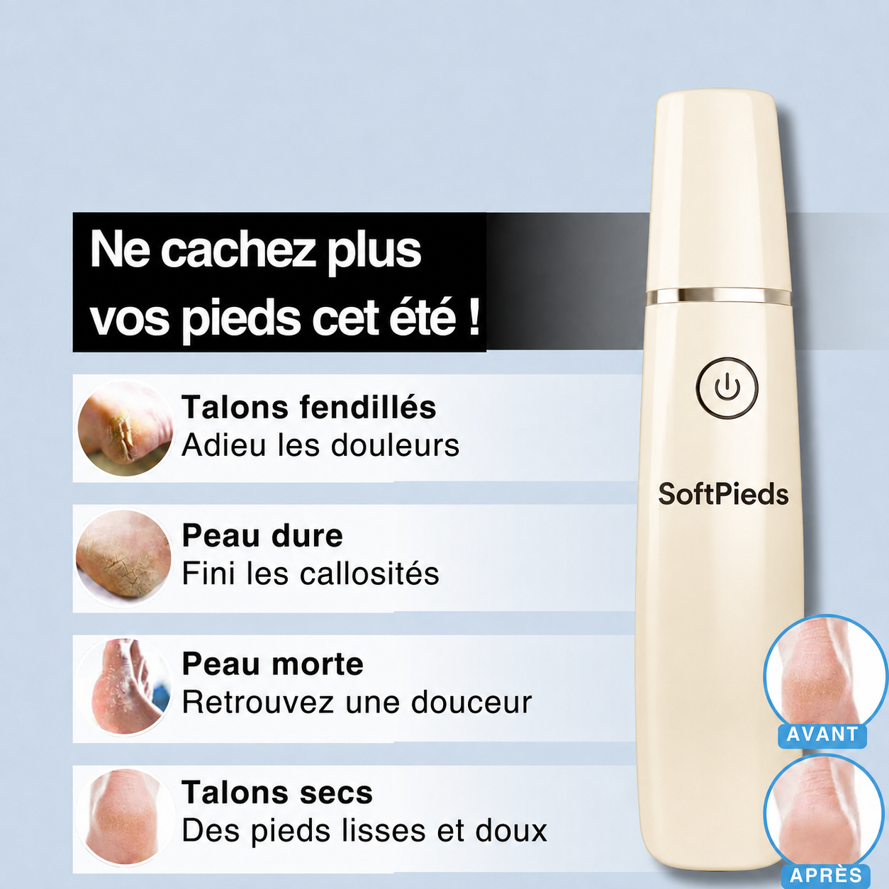 SoftPieds™- Appareil de Pédicure Anti Callosités
